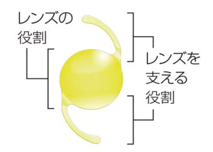 眼内レンズの構造