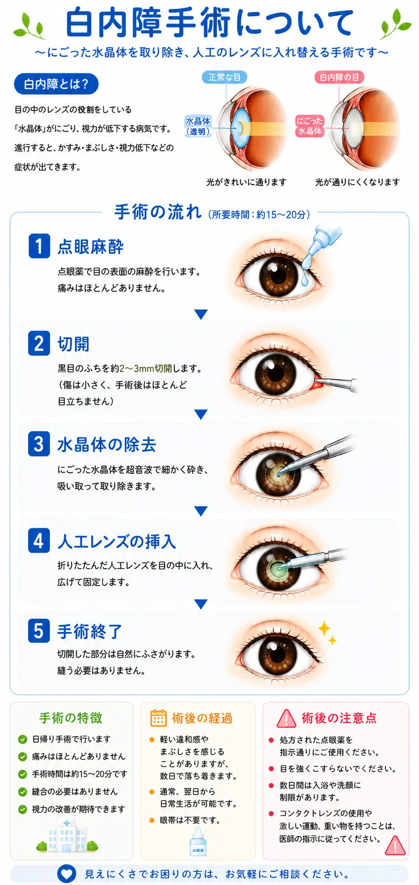 白内障手術について