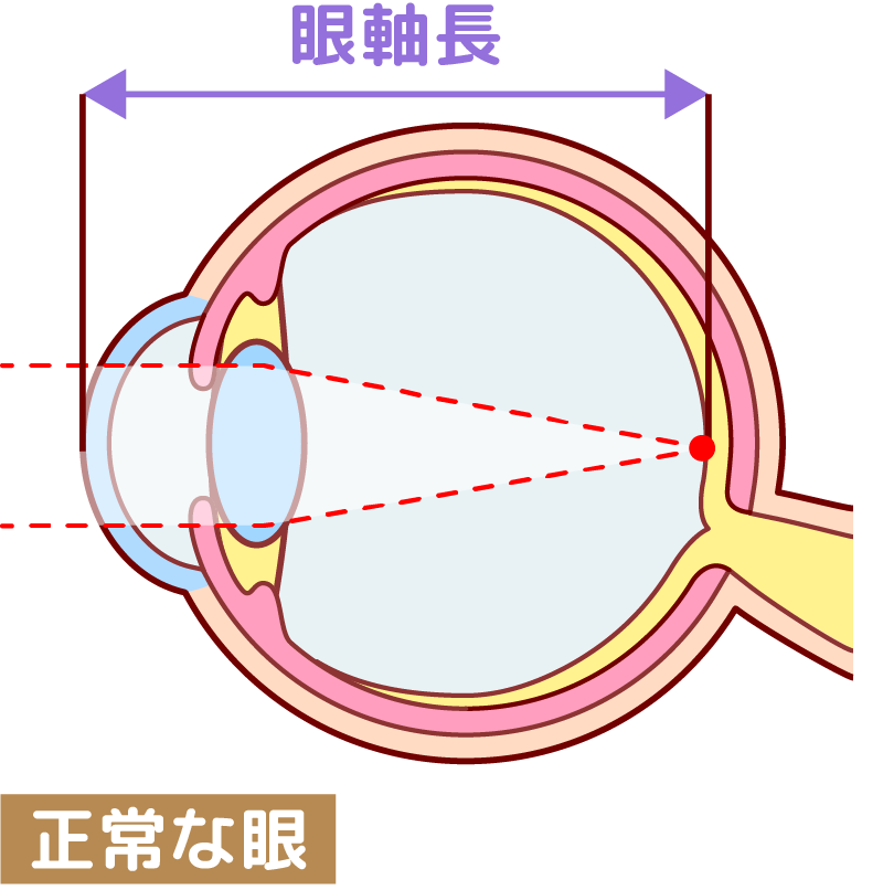 正常な眼イメージ