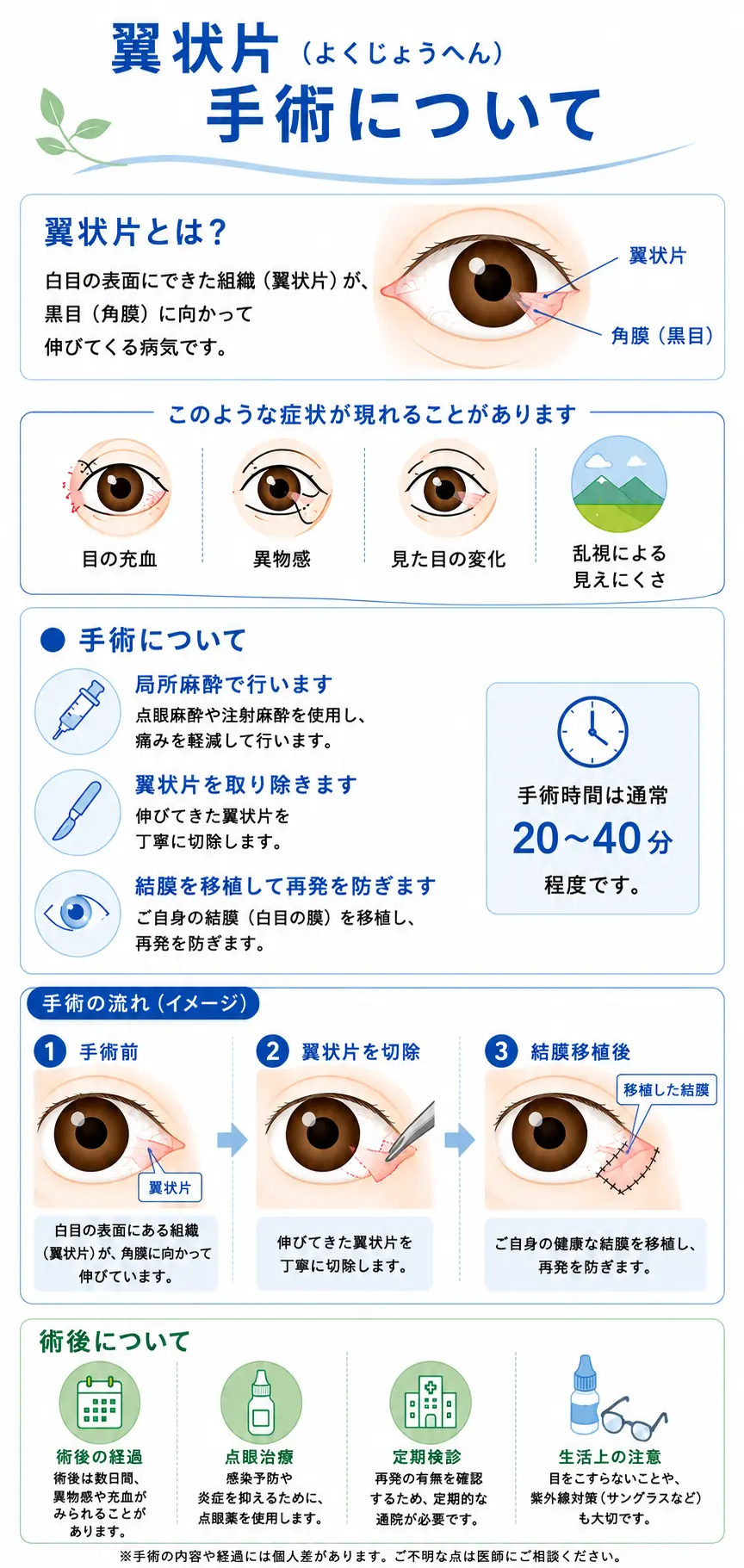 翼状片手術について